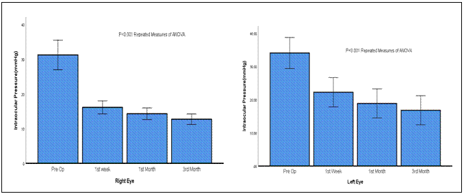 Text Box:        
FIGURE-1(a) and 1(b):Mean post-operative IOP at each time point is significantly lower than pre op IOP for right and left eye in unilateral cases (p<0.001). ANOVA indicates analysis of variance.
